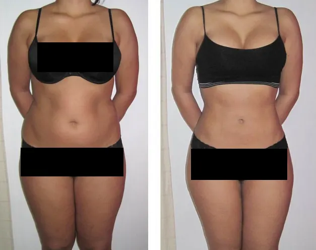 Antes y después – Programa SlimBody