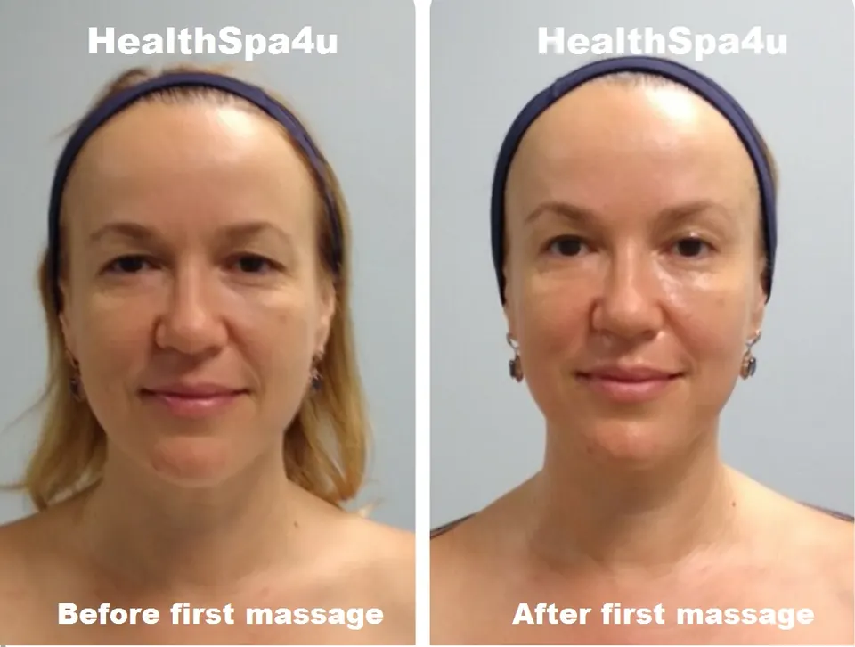 Antes y después – Masaje Facial Escultural