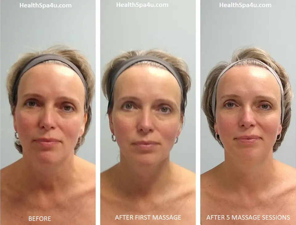 Antes y después – Masaje Facial Escultural