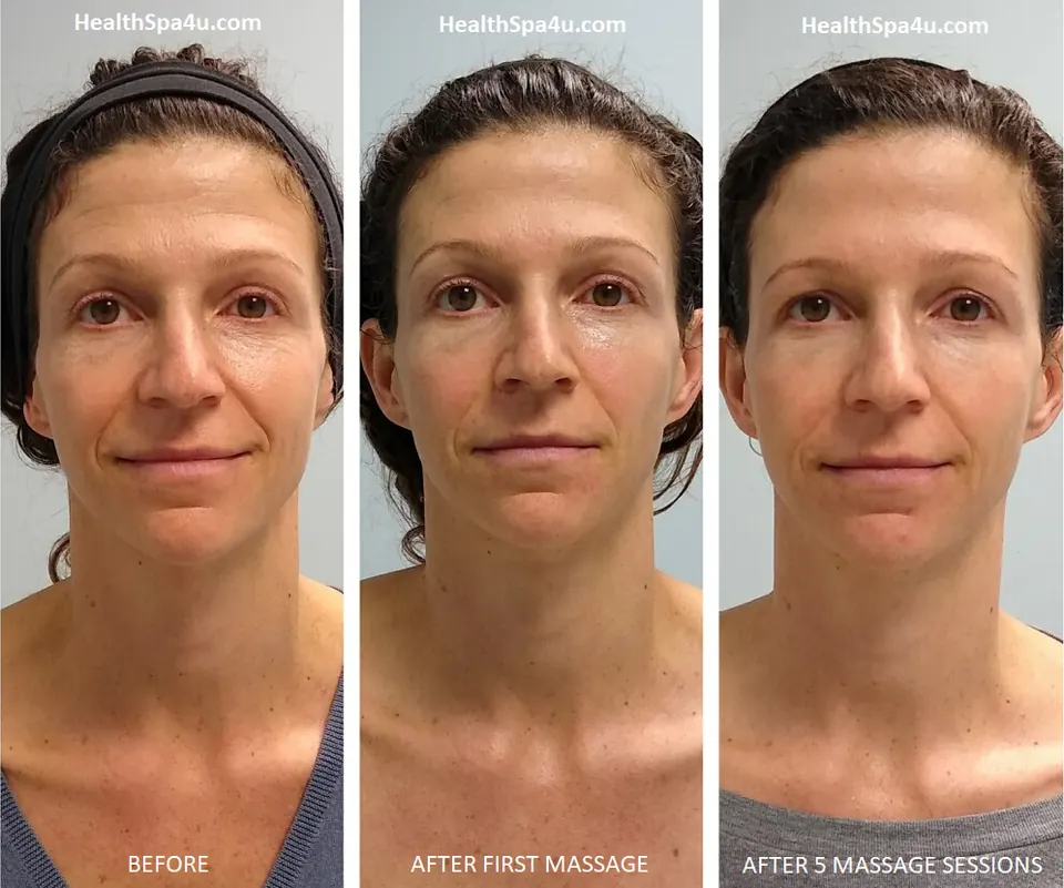 Antes y después – Masaje Facial Escultural